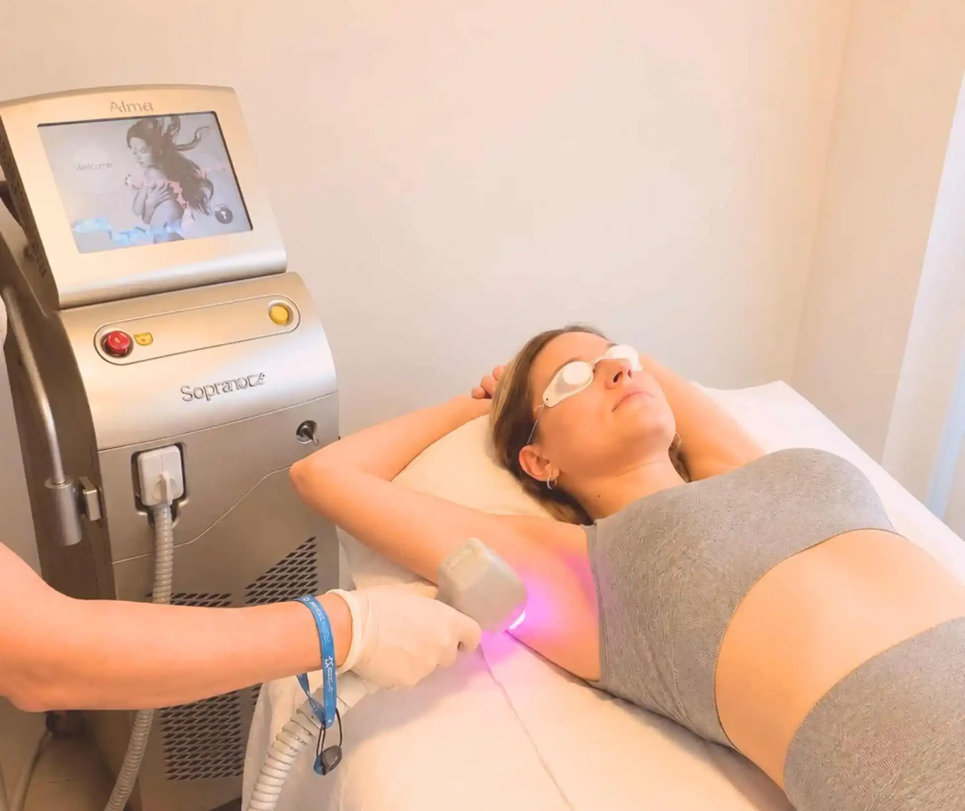 depilacion laser